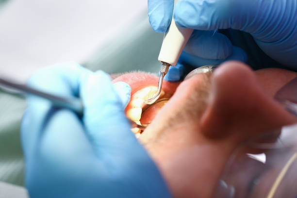 Best Emergency Dental Care for Broken or Chipped Teeth in Follansbee, WV